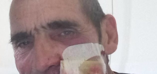 Cagnotte pour le gilet jaune bordelais défiguré par un tir de flashball