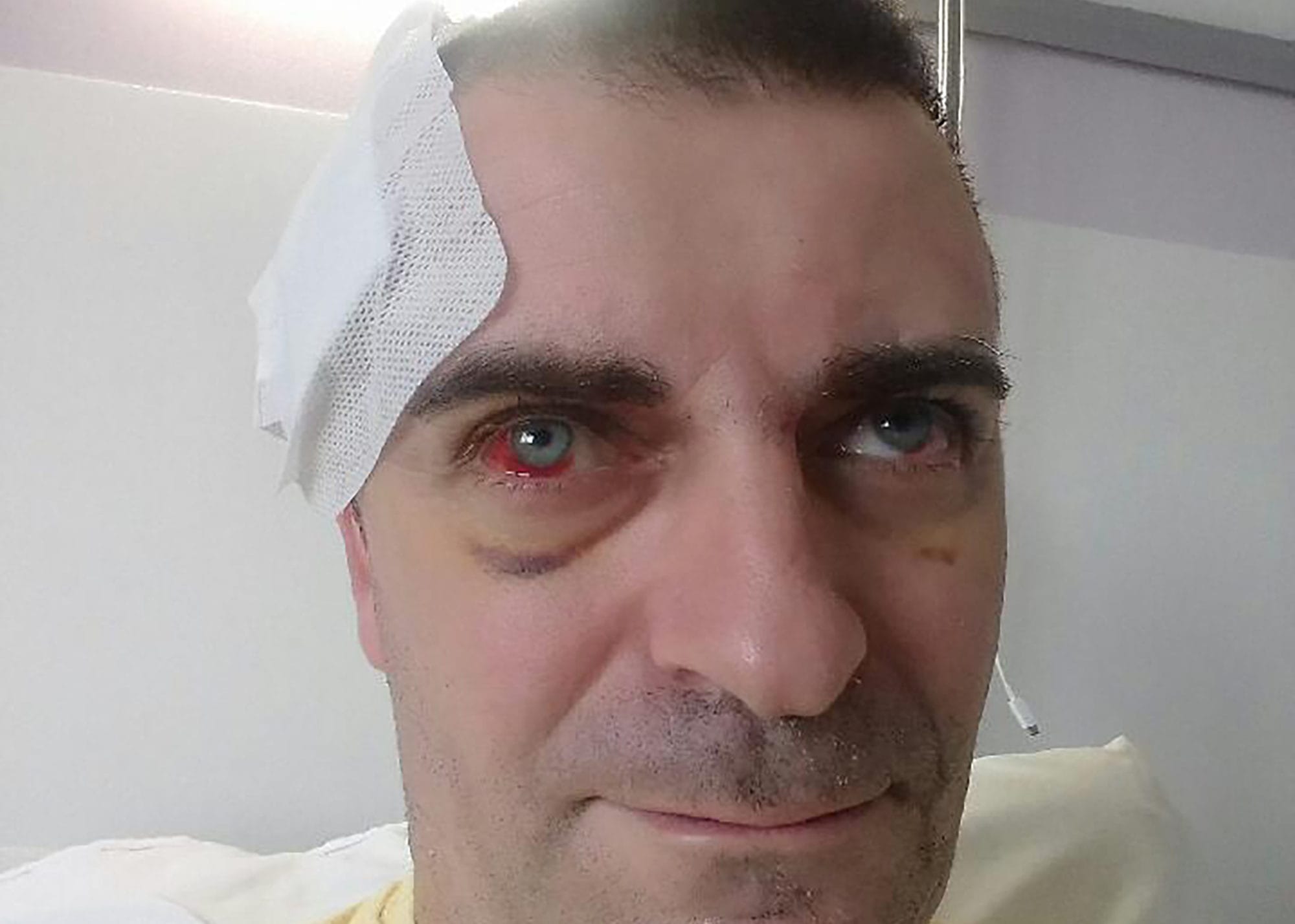 Le difficile combat d’Olivier Béziade, pompier volontaire blessé à Bordeaux lors d’une manifestation des Gilets jaunes