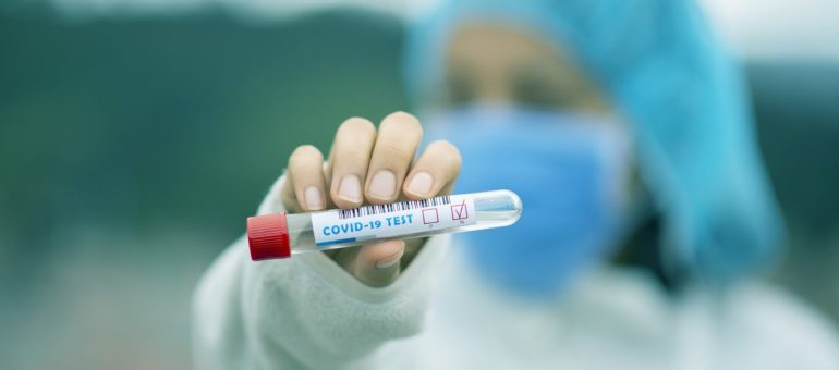 Coronavirus : face aux signaux d’alerte, des dépistages massifs en Gironde